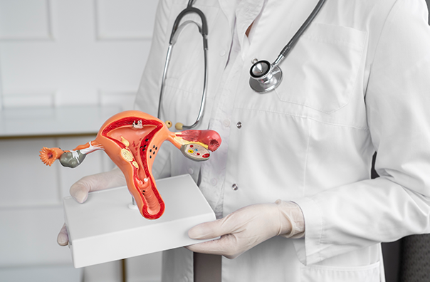 Eficácia dos antioxidantes na redução da dor pélvica devido à endometriose