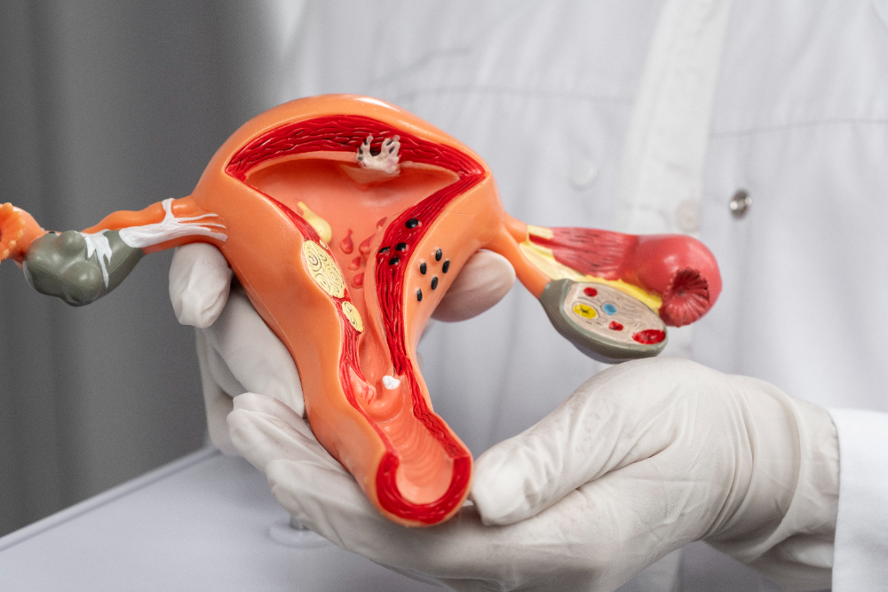 Uso de Suplementação Oral com Sulfato de Zinco para Combater Infecção por HPV e Melhorar Citologia Cervical